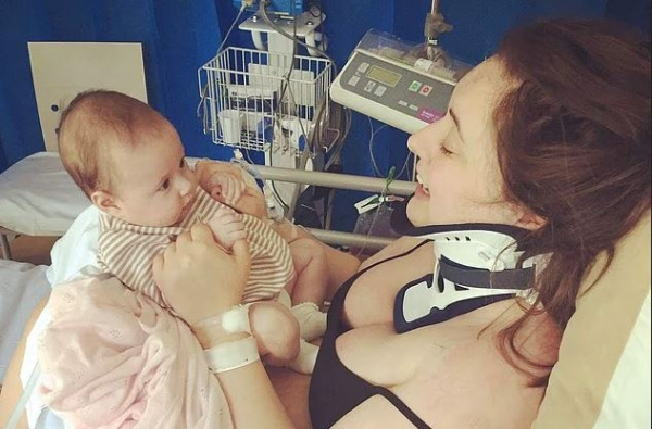 Женщина сломала шею, неудачно зевнув